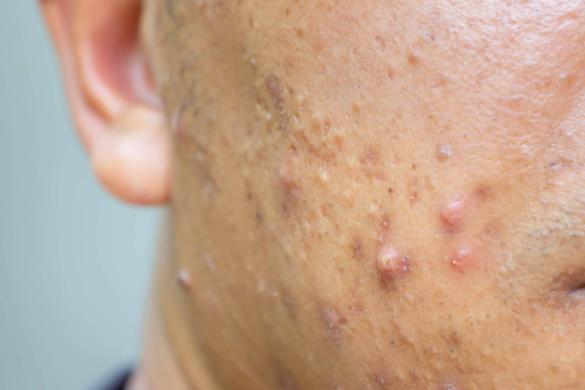Cuidado de la piel con una amplia gama de productos de CBD